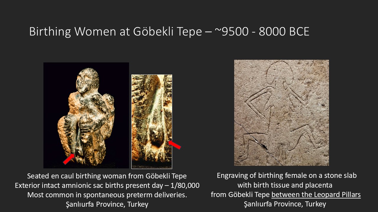 Göbekli Tepe (ගෝබෙක්ලි ටෙපේ): ගොවිතැනටත් කලින් හදපු දැවැන්ත ගල් කුළුණු